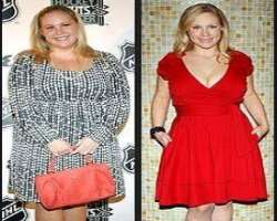 Caitlin Van Zandt before surgery